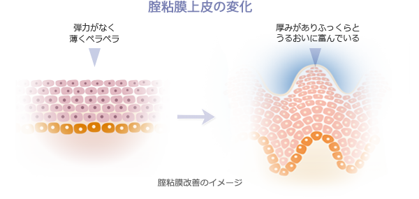 膣粘膜上皮の変化