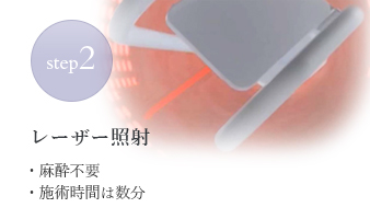 Step2 レーザー照射