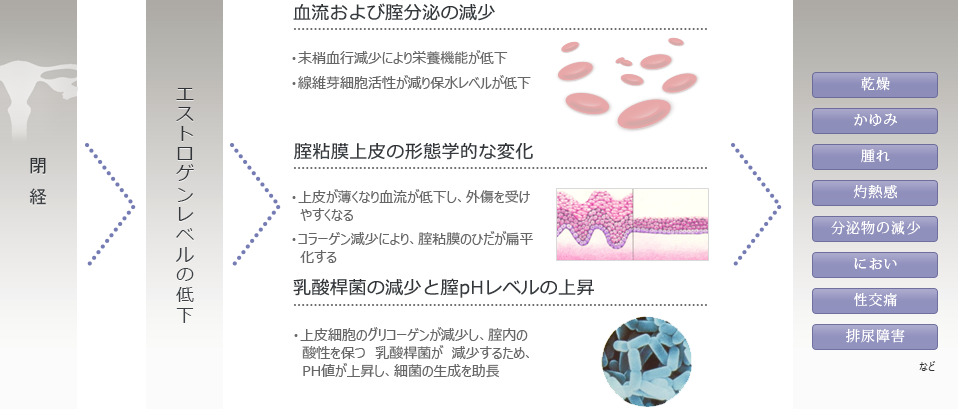 腟萎縮のメカニズム